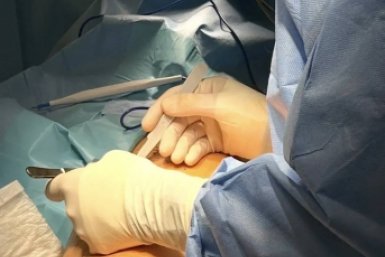 Хирурги Владивостока спасли ногу 21-летнему участнику СВО пресс-служба Минздрава Приморья